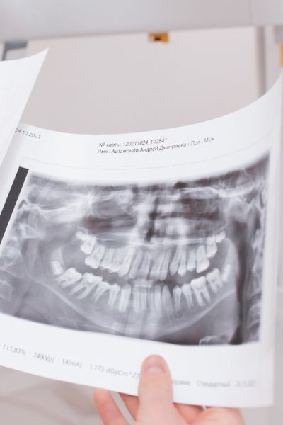 2D/3D- диагностика зубов