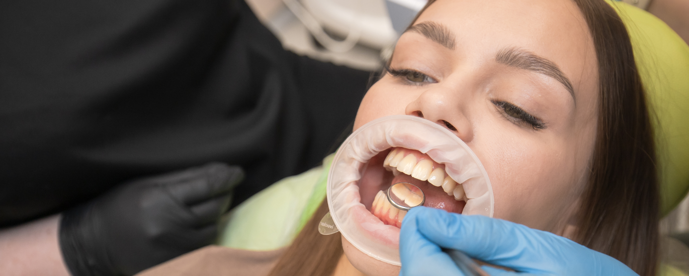 Акция на чистку зубов