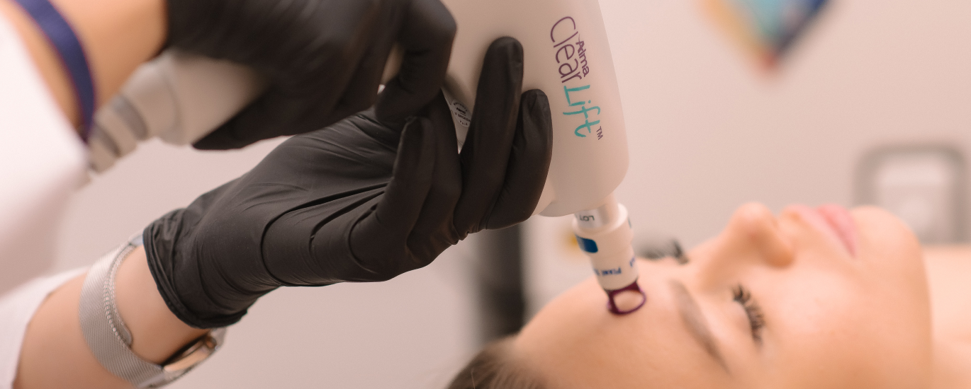 Лазерное омоложение Clearlift
